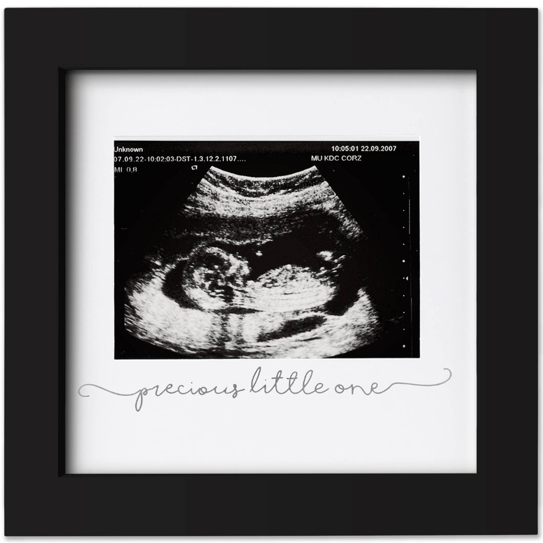 Baby Sonogram Picture Frame by KeaBabies
